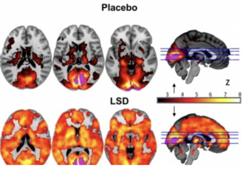 Understanding the effect of psychedelics