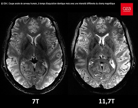 Human neuroimaging