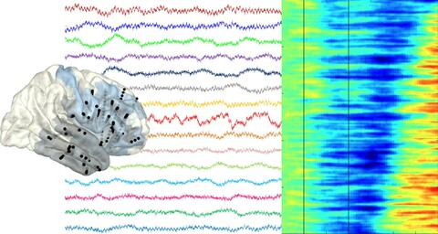Human electrophysiology